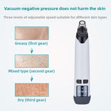 Electric Blackhead Remover with Hot Compress and 4 Suction Heads